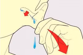 Mẹo xử trí khi bị nước vào tai an toàn, không gây nhiễm trùng