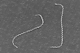 Suýt mất mạng do nhiễm Leptospira - hiểm hoạ từ chuột, ai có nguy cơ mắc?