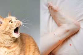 Người phụ nữ tử vong sau 6 tháng bị mèo cào vào chân