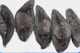 Đau bụng âm ỉ, đi khám ngỡ ngàng vì khối dị dạng hiếm gặp ở nách