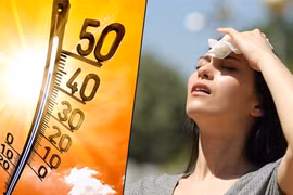 Dấu hiệu nhận biết sốc nhiệt do nắng nóng