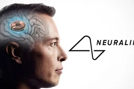 Công ty của Musk lần đầu tiên cấy chip không dây vào não người