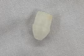 Gắp dị vật đầu bút trong đường thở bé trai 6 tuổi