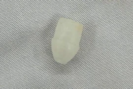 Gắp dị vật đầu bút trong đường thở bé trai 6 tuổi