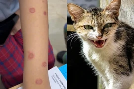 Cả gia đình nhiễm nấm da lây từ mèo, bác sĩ cảnh báo