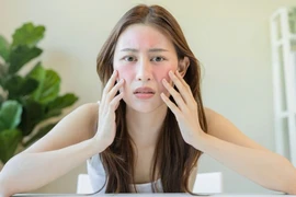 Dấu hiệu nhận biết da đang trong tình trạng dị ứng mỹ phẩm