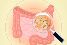 Dấu hiệu cảnh báo đường ruột cực "bẩn", cần cải thiện ngay