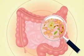 Dấu hiệu cảnh báo đường ruột cực "bẩn", cần cải thiện ngay