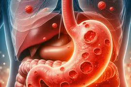 "Điểm" 7 thói quen xấu "phá nát" dạ dày, nhiều người mắc phải