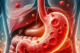 "Điểm" 7 thói quen xấu "phá nát" dạ dày, nhiều người mắc phải