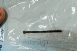 Gắp dị vật đinh vít dài 4cm trong dạ dày bé trai 3 tuổi