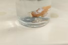 Đau ngực, khó thở, đi khám bất ngờ phát hiện răng giả mắc kẹt trong phổi