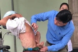 Thanh Hoá: Hàng loạt người "bỗng dưng" bị ngứa kéo dài không rõ nguyên nhân