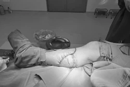 Người đàn ông bị bò giẫm nát chân phải nhập viện cấp cứu khẩn cấp