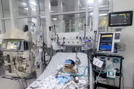 Bị ong vò vẽ đốt 70 vết, bé trai 7 tuổi tổn thương đa cơ quan