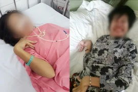 Mắc bệnh Wilson hiếm gặp, cô gái bị chẩn đoán tâm thần phân liệt