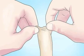 Chủ quan lộn bao quy đầu tại nhà, bé trai 5 tuổi nhập viện 