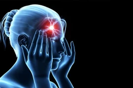 "Điểm” 8 triệu chứng phổ biến cảnh báo nhồi máu não, cần lưu ý