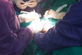 Không nên chủ quan với bệnh ung thư dương vật