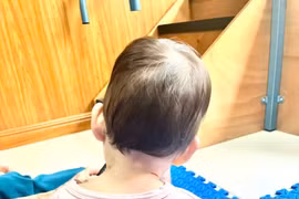 Bé 4 tháng tuổi bị vẹo cổ, nguyên nhân khiến cha mẹ bất ngờ