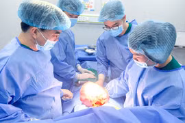 Bóc thành công khối u buồng trứng ác tính khổng lồ cho cụ bà 69 tuổi