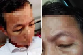 Vụ Hiệu trưởng đánh hiệu phó phải nhập viện: Hé lộ nguyên nhân bất ngờ