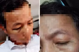 Vụ Hiệu trưởng đánh hiệu phó phải nhập viện: Hé lộ nguyên nhân bất ngờ