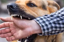 Người đàn ông tử vong do bệnh dại sau 4 tháng bị chó cắn