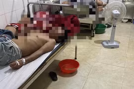 Hà Tĩnh: Nhiều người nhập viện cấp cứu do ăn tiết canh bê