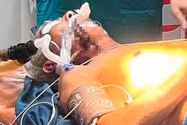 Hà Tĩnh: Cứu cụ ông bị thanh sắt đâm xuyên cổ