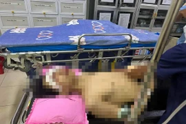 Nam sinh bị dập nát bàn tay, tổn thương 2 mắt sau tiếng nổ lớn