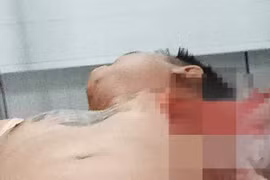 Đang ngồi nhậu cùng bạn, nam thanh niên bị chém trọng thương