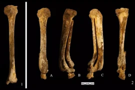 Bộ xương cổ đại tiết lộ hình phạt chặt chân phụ nữ Trung Quốc 3.000 năm trước 