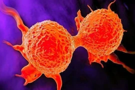 Nếu ở cổ có 3 “tín hiệu” thì có thể là báo hiệu cho tế bào ung thư “hoạt động”