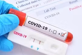 Lật hồ sơ Y tế Đức Minh nhập khẩu kit xét nghiệm COVID-19 “khủng” hơn Việt Á