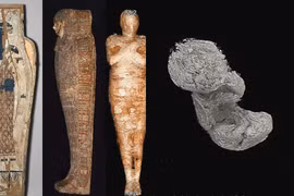 Xác ướp Ai Cập mang thai: Thai nhi 28 tuần được bảo quản vô cùng hoàn hảo