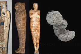 Xác ướp Ai Cập mang thai: Thai nhi 28 tuần được bảo quản vô cùng hoàn hảo