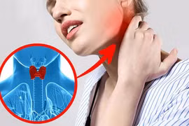 8 dấu hiệu cảnh báo sớm bệnh tuyến giáp ở phụ nữ