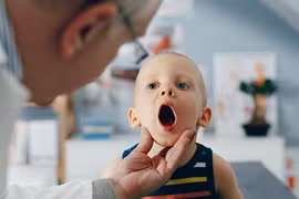 Trẻ bị viêm amidan tái phát thường xuyên phải làm sao?