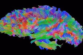 Những phát hiện khoa học khiến ai cũng bất ngờ thảng thốt
