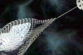  Nhật Bản sẽ dùng lưới đánh bắt rác không gian