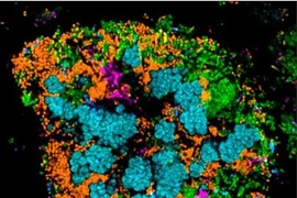 Chùm ảnh đẹp lạ các vi khuẩn sống trên răng bạn