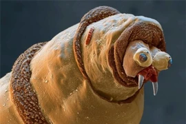 Hình ảnh vạn vật đời thường vô cùng kinh dị nhìn qua kính hiển vi