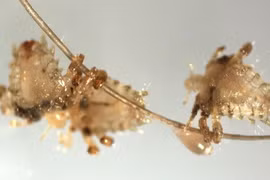 Tận mắt nhìn loài rận chuyên ký sinh ở…”vùng kín” con người