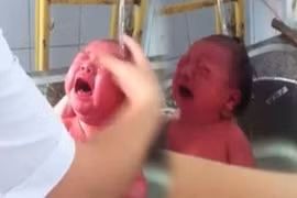 Tắm trẻ sơ sinh trong bồn rửa bát: Giám đốc BV nói gì?