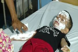 Nổ bóng bay hydro: Thận trọng với những “quả bom” di động 