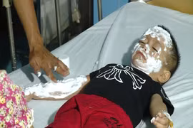 Nổ bóng bay hydro: Thận trọng với những “quả bom” di động 