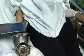 Người phụ nữ vô tình bị cuốn cả bàn tay vào máy xay thịt