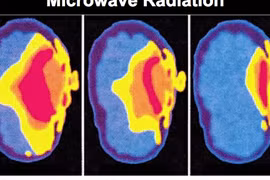  Điện thoại di động có thể gây ung thư não, vô sinh