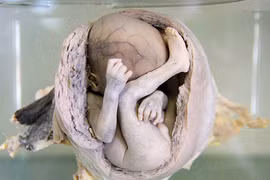 Điều khiếp đảm ở bảo tàng rùng rợn nhất Thái Lan